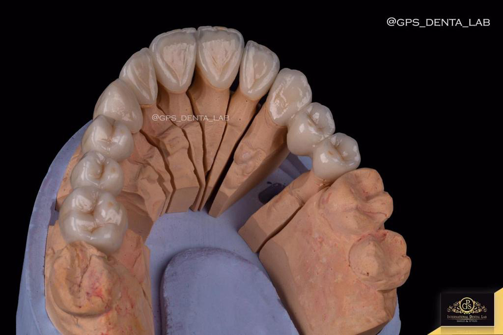 Smile transformation 18