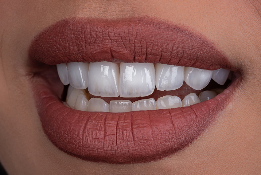 Smile transformation 7